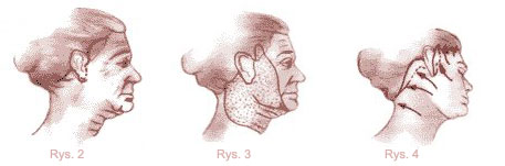 rys1