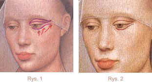 rys1